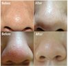 blackhead off sheet-1_3.jpg
