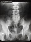 XRay.jpg